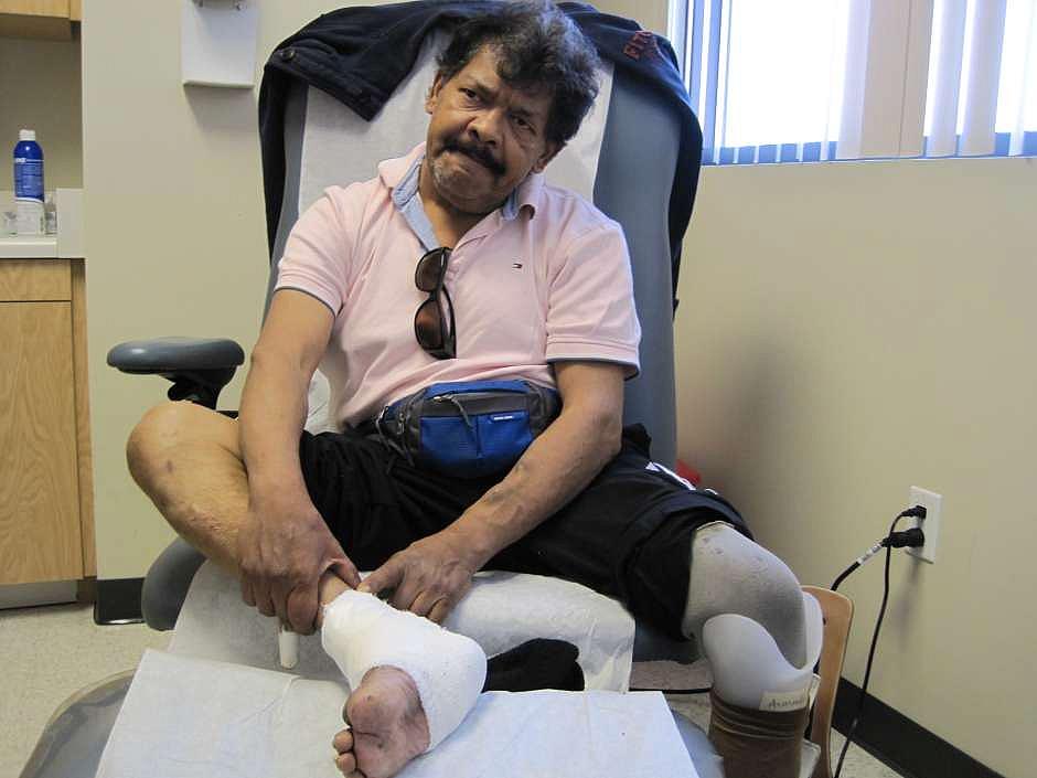 Armando Salgado is seen in a room at the Center for Limb Preservation and Advanced Wound Care at Adventist Health White Memorial in Boyle Heights, where he has been treated for a year. (Francisco Castro) Photo by Francisco Castro
