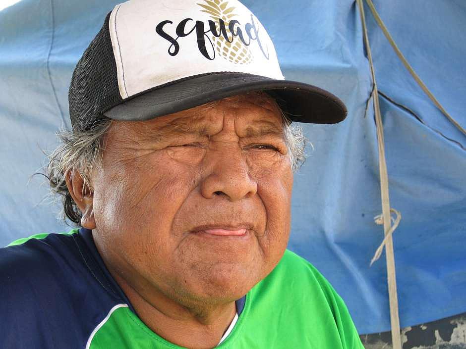 Venancio Martinez is completely blind from his right eye. He only sees a little bit of clarity on his left, product of the diabetes he’s been suffering for 20 years. (Francisco Castro) Venancio Martinez is completely blind from his right eye.