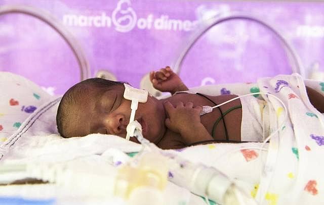 The March of Dimes released a report Wednesday on how the country and cities are faring with premature births.