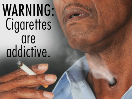 cigarette warning label, reporting on health, tracheotomy